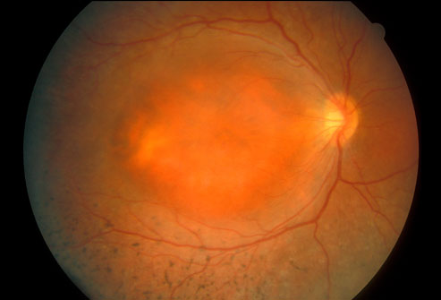 مشکلات و بیماری های چشمی و روش های شناسایی آن ها 1