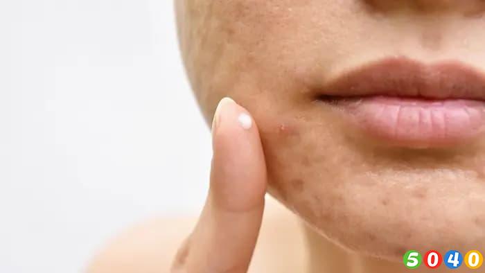  کرم ضد لک مناسب برای پوست- 5040