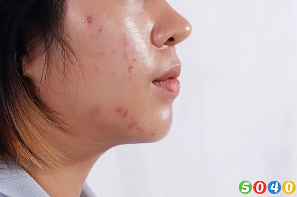 مراقبت از پوست-5040