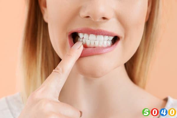 بهترین روش برای سفید کردن دندان