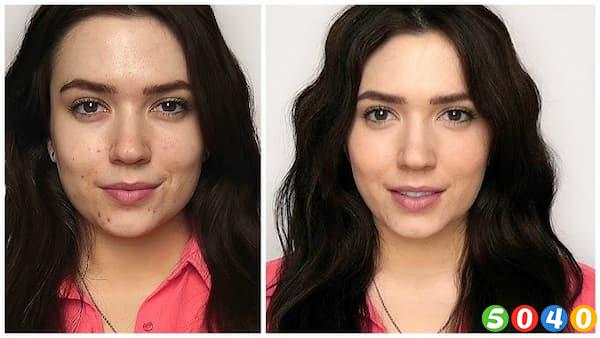 قبل و بعد استفاده از دی دی کرم پوست چرب-5040