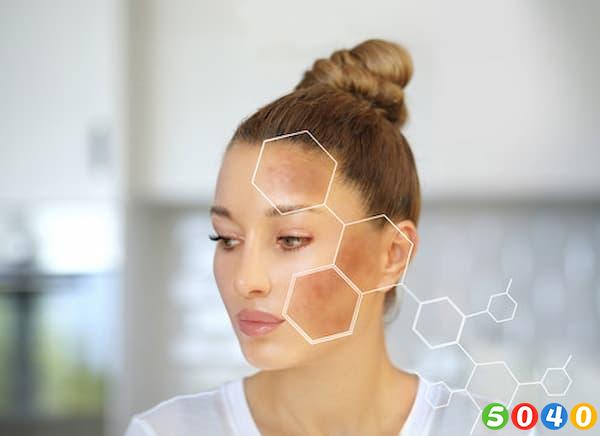 چگونه لک های پوستی را درمان کنیم؟5040