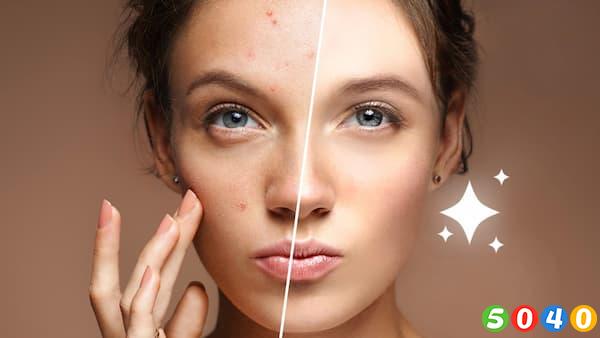 درمان و رفع لک های پوستی-5040